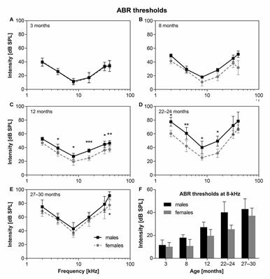 Age-Related Differences in Hearing Function and Cochlear Morphology between Male and Female Fischer 344 Rats